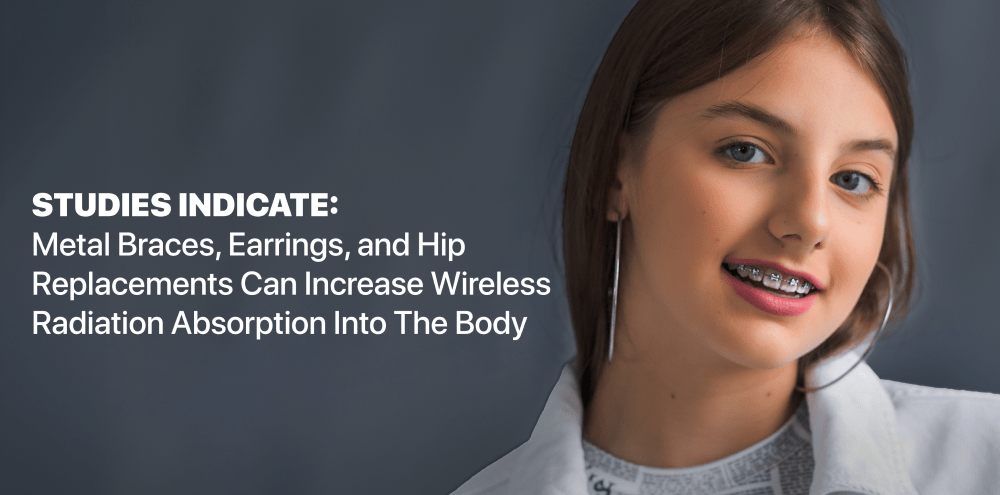 How Metal Braces, Earrings, and Implants Can Amplify Wireless Radiation Exposure, Study Says