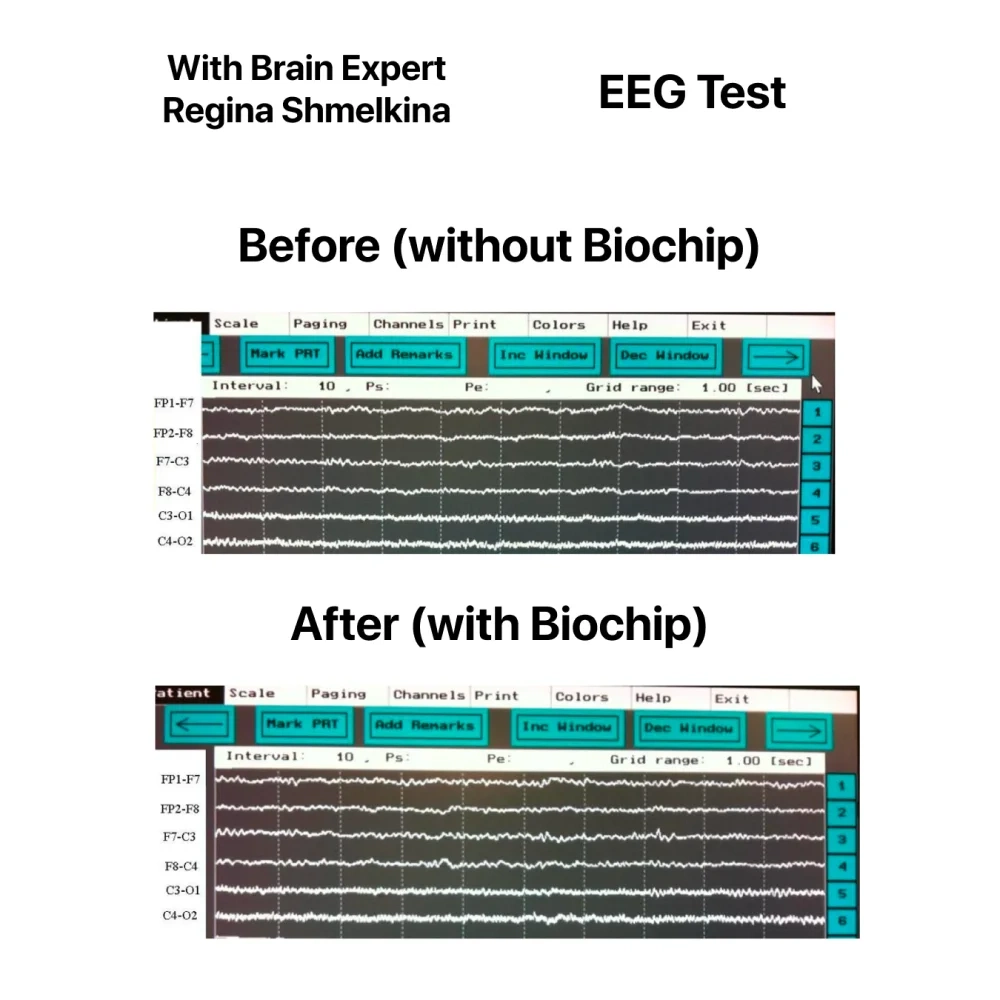 BioChip - EMF Protection