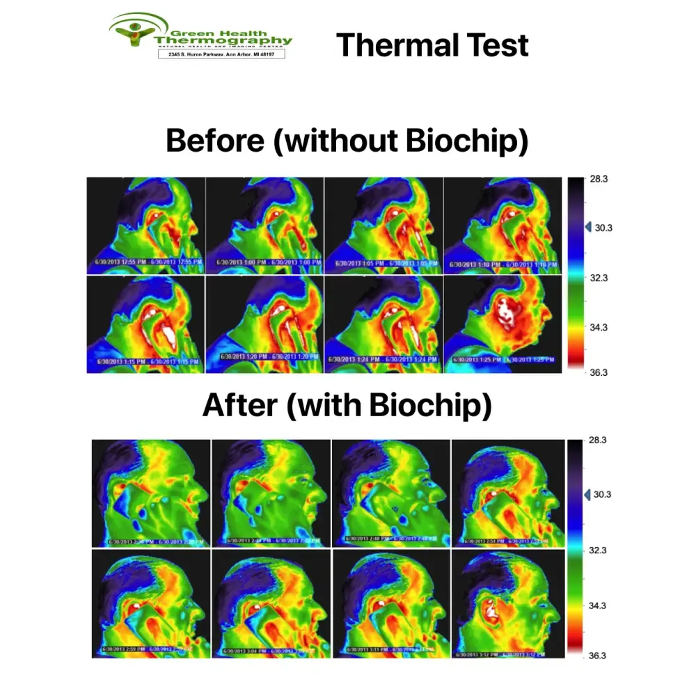 BioChip - EMF Protection